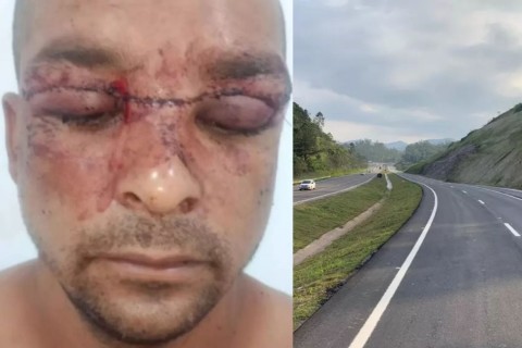 Homem leva 100 pontos após ter rosto cortado por linha de cerol na BR-470